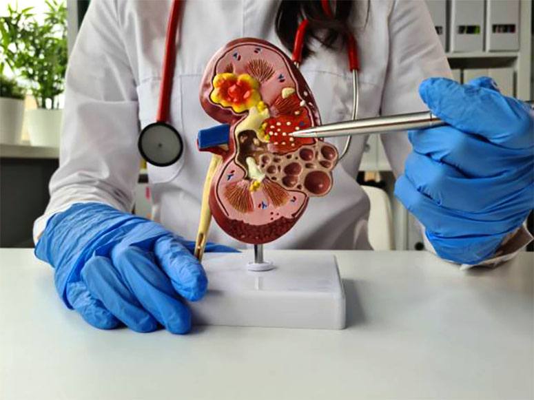 Hand show the inside of a kidney