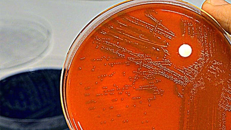 Petri dish with orange liquid