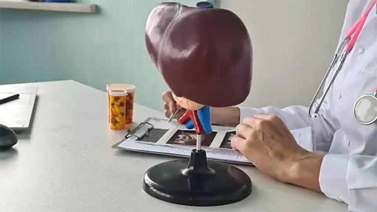 A female doctor taking notes, and next to her is a model of a liver