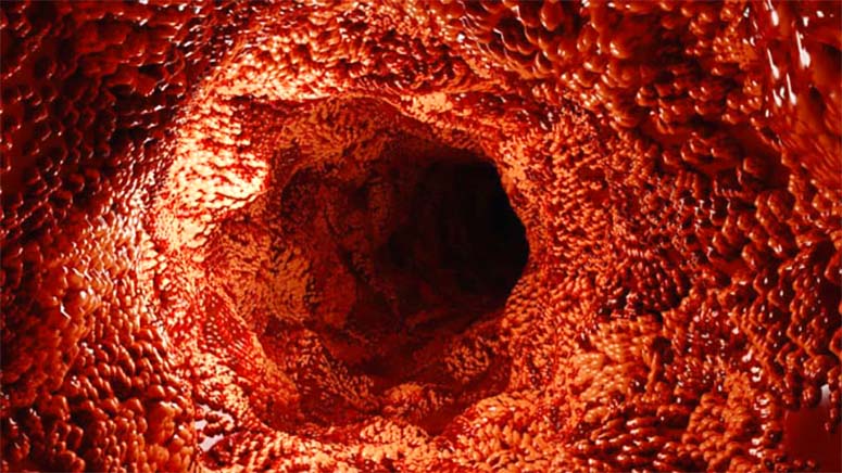 Picture of a large intestine from the inside